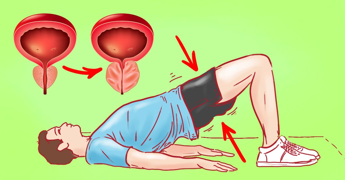 gymnastic exercises for prostatitis